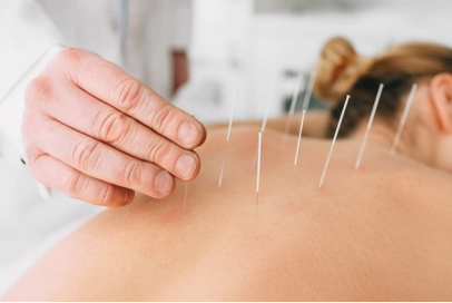 acupuntura sistêmica